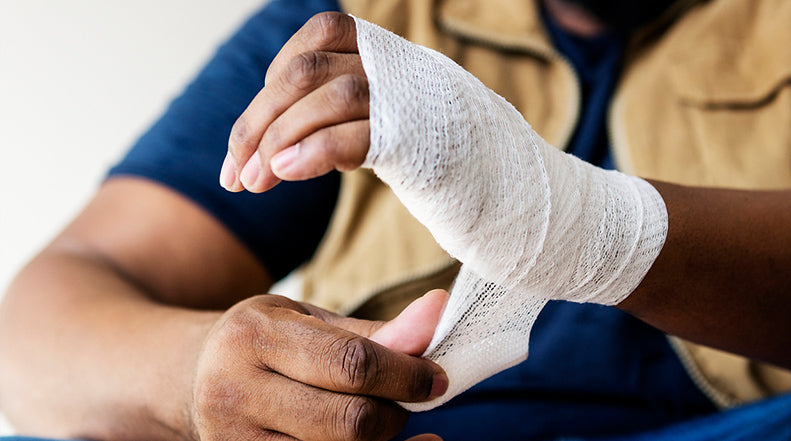 What Makes Burn Scars Different?
