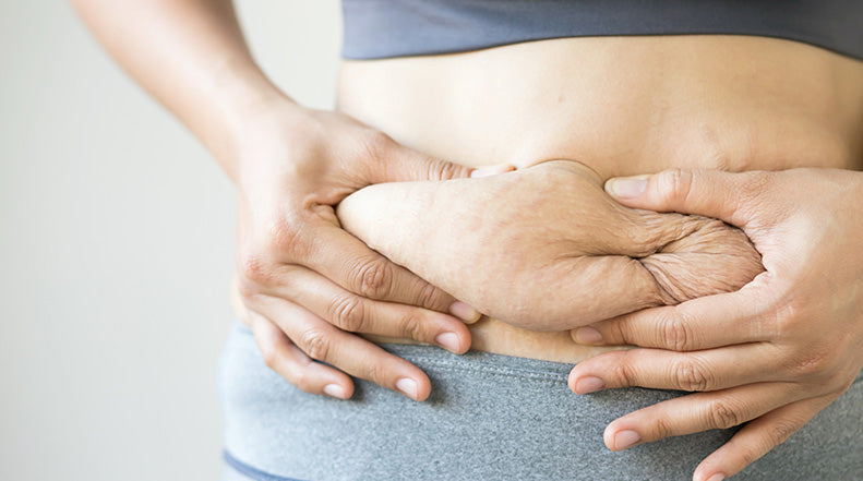 The Best Way to Tighten Loose Skin After Pregnancy