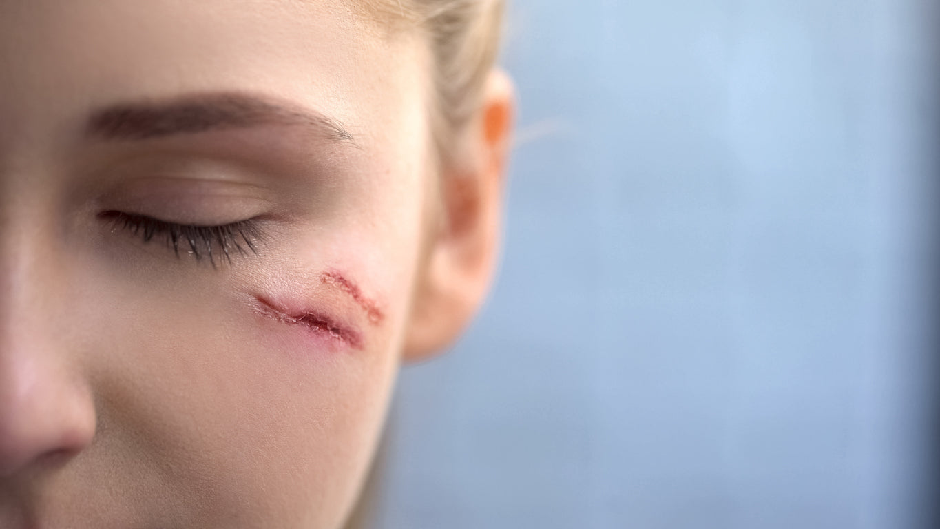How Long Does it Take For a Scar to Heal?