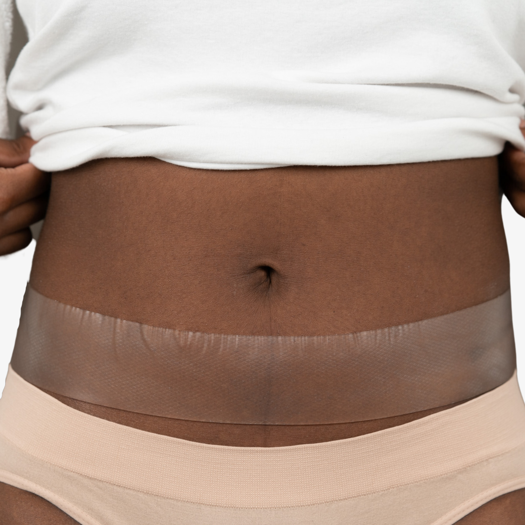 Advanced Medical-Grade Silicone 2" x 24" Roll applied on black women's stomach| clear