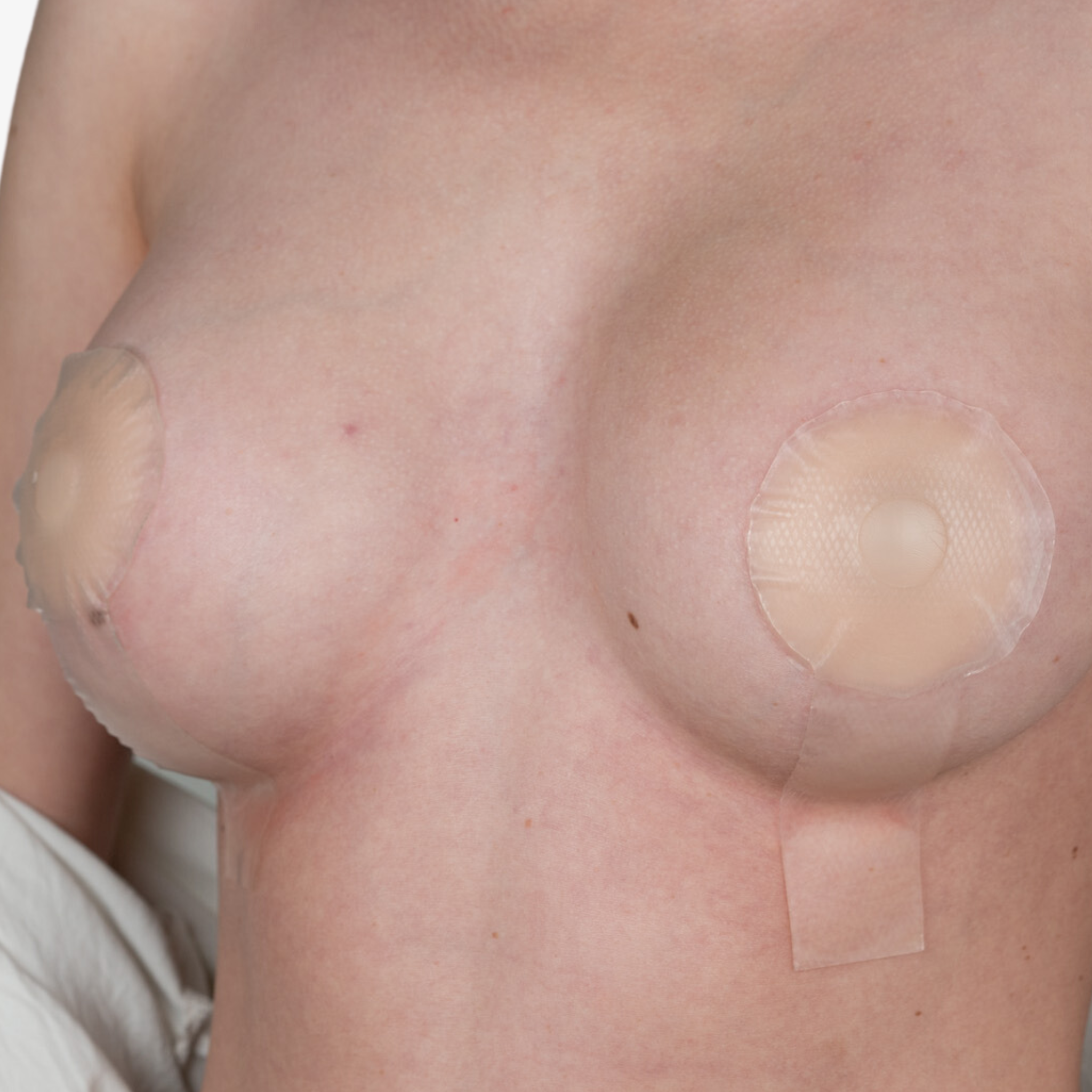 Advanced Medical-Grade Silicone Breast Lollypop Sheet on caucasian women's breast close up | clear