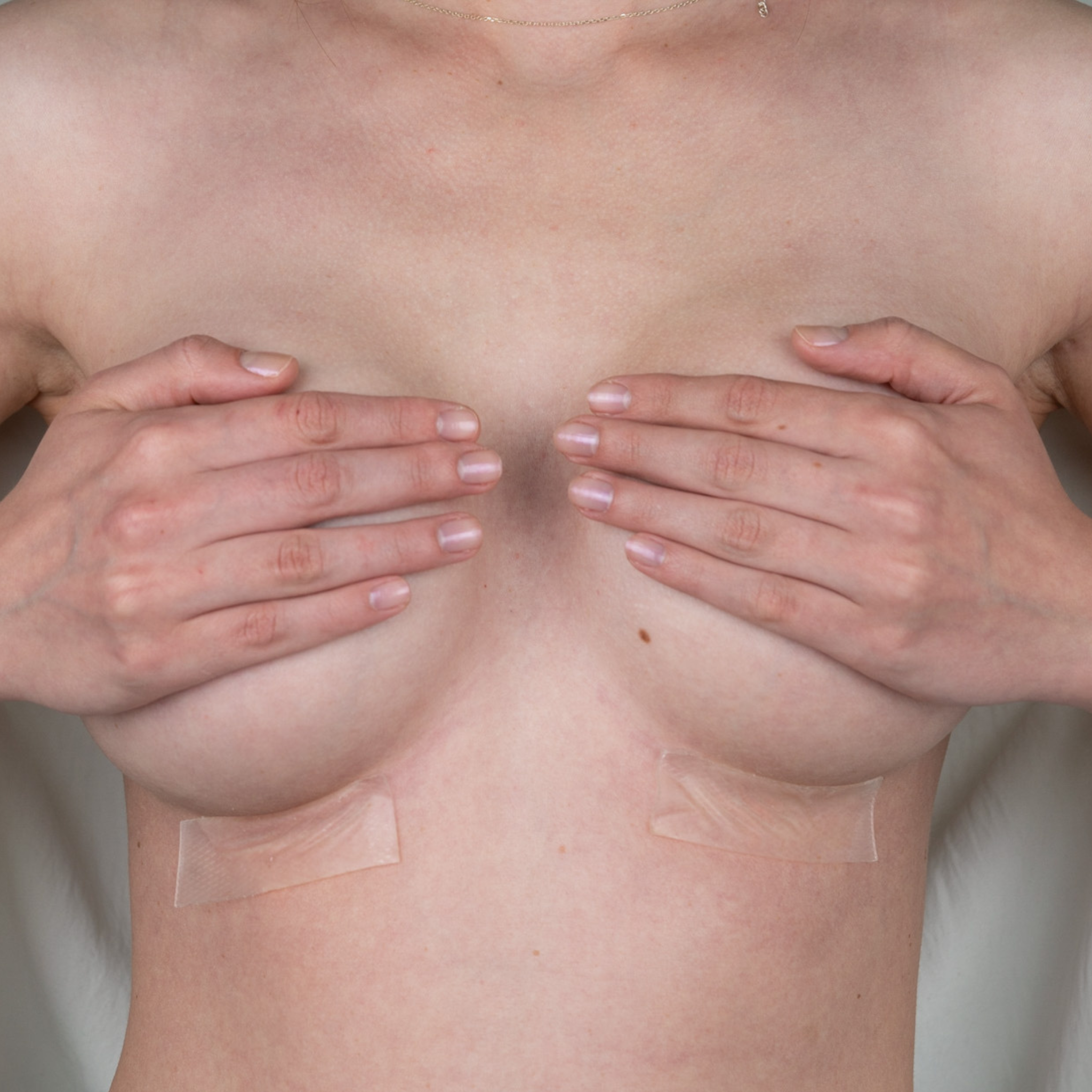 Advanced Medical-Grade Silicone 1" x 3" strips below Caucasian women's breast | clear