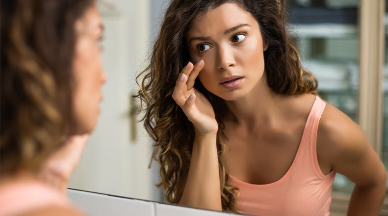 How to Get Rid of Dark Circles and Baggy Eyes