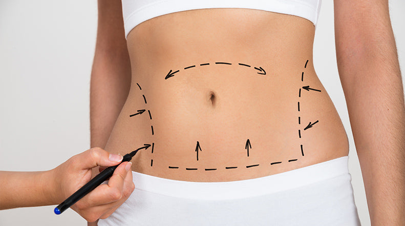 What You Need to Know Before Getting Liposuction