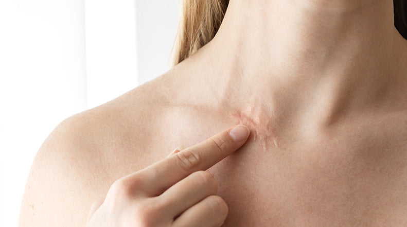 Which Part of Your Body Scars the Worst?