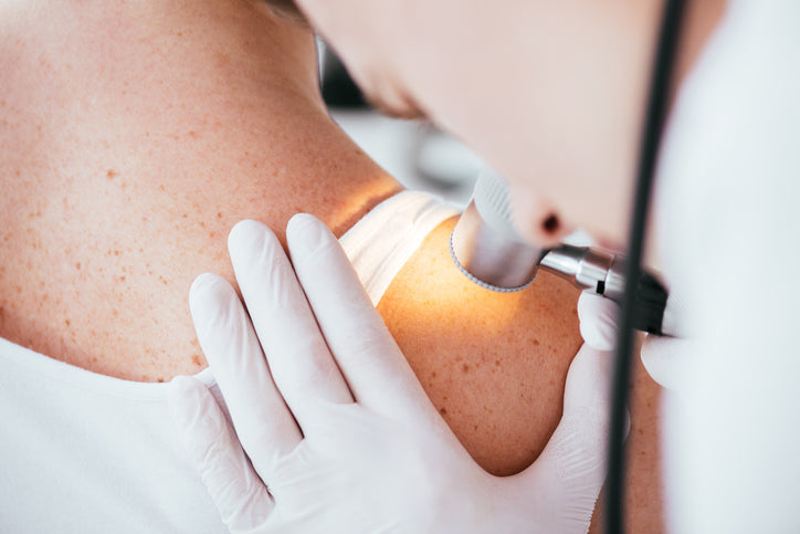 Skin cancer treatment and statistics