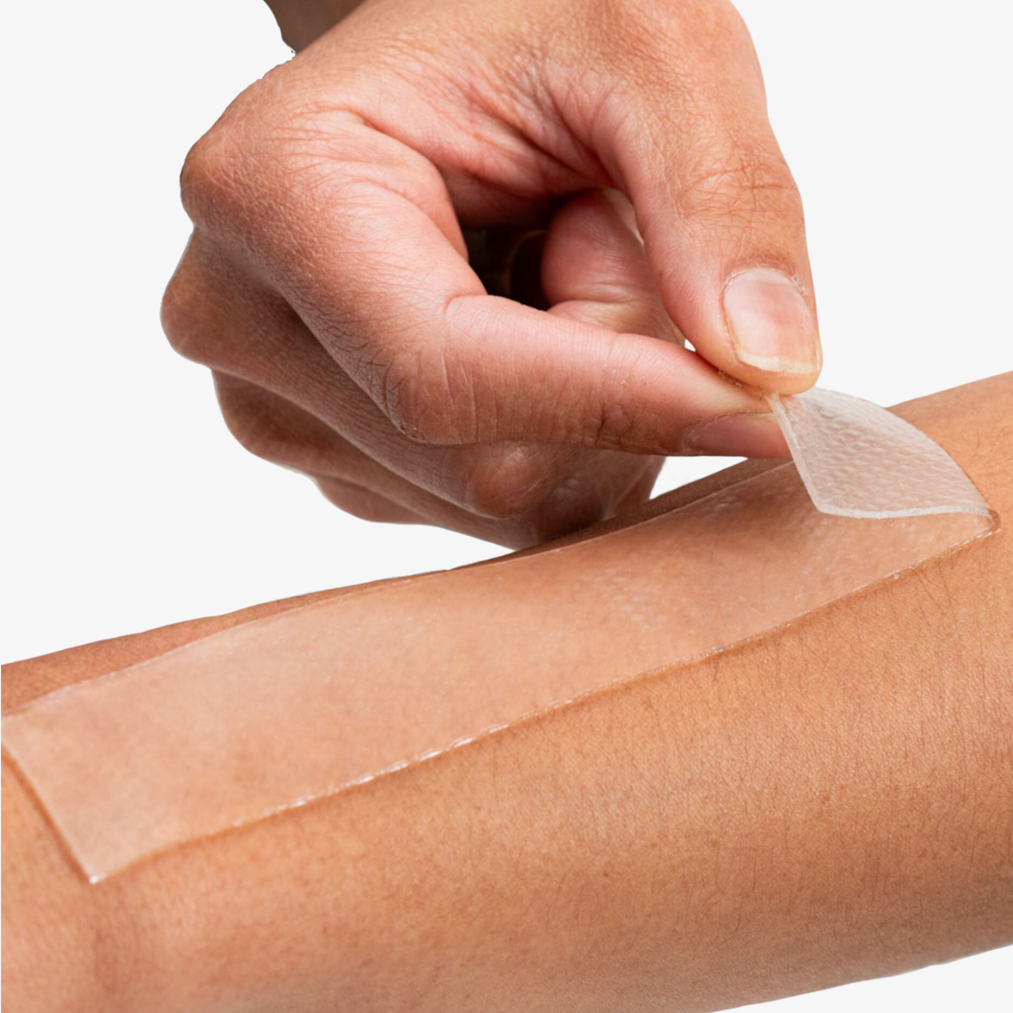 Silicone gel sheeting being applied to white women's arm