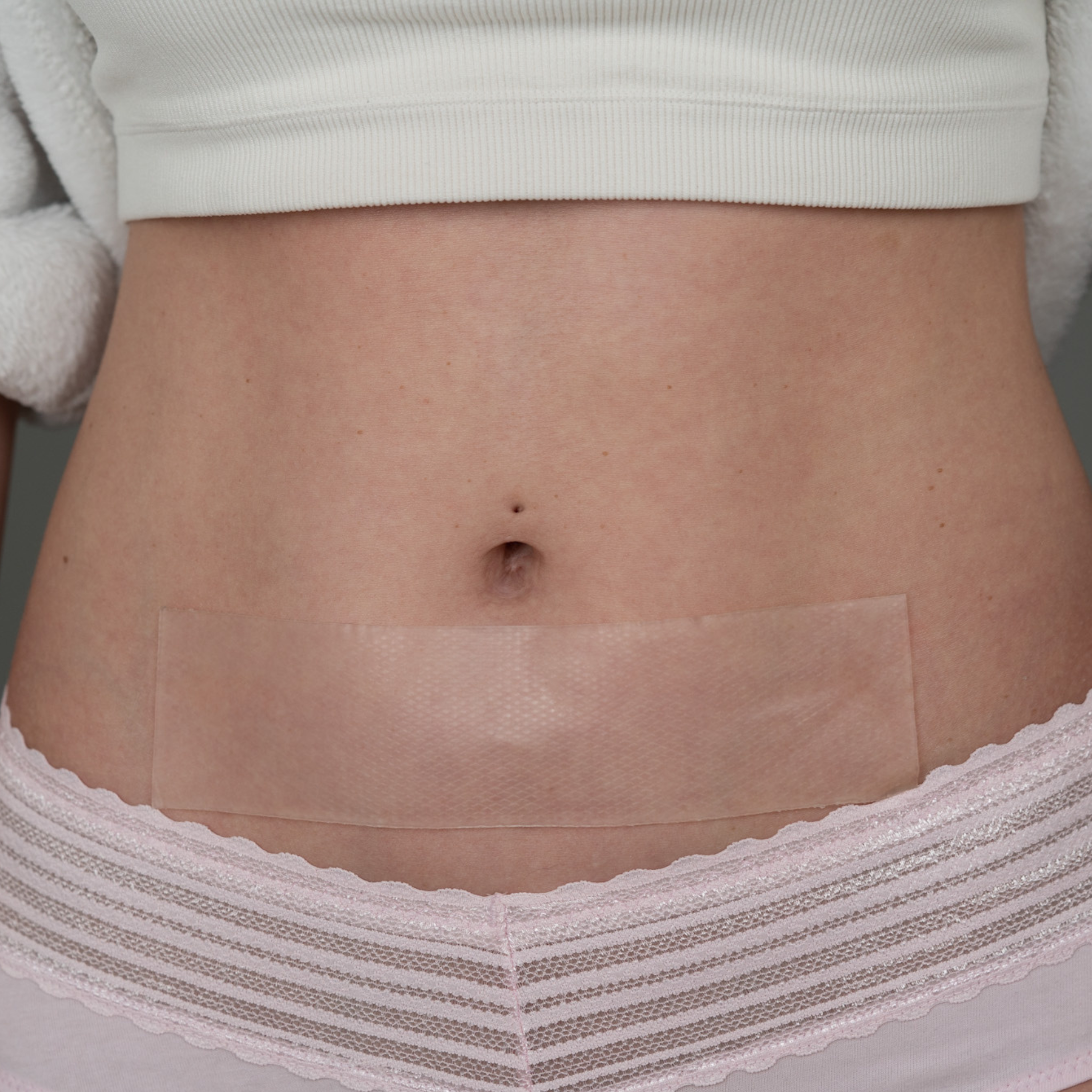 Advanced Medical-Grade 2" X 8" Strip on caucasian women's stomach | clear