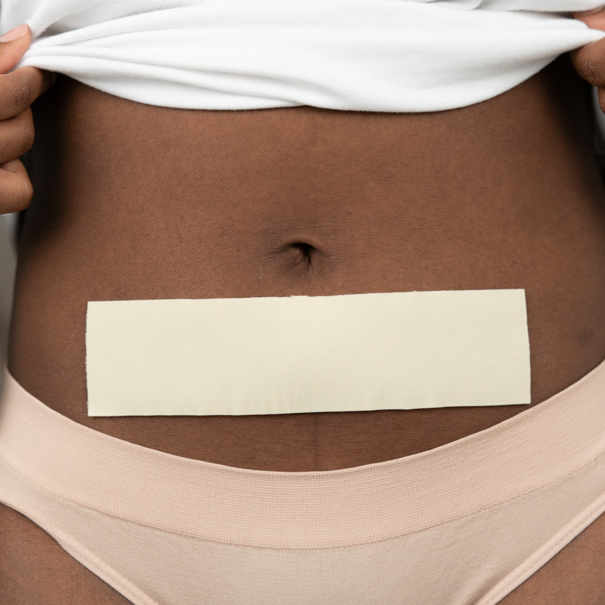 Advanced Medical-Grade 2" X 8" Strip on black women's stomach | beige